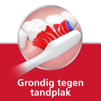 pdp-image-Parodontax soft tb