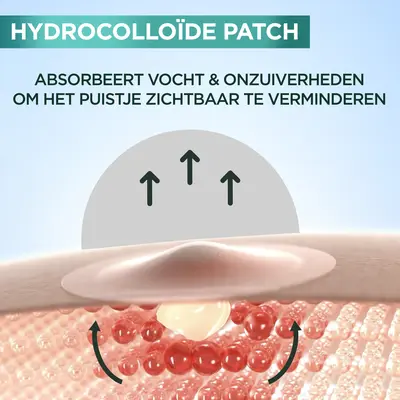pdp-image-Garnier Pimple patch