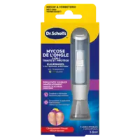 Scholl Kalknagel behandelset